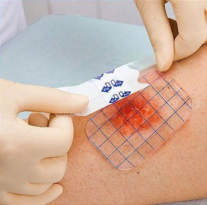 Curativo Hidrogel Hydrotac Transparent - 10 x 10 cm - Hartmann